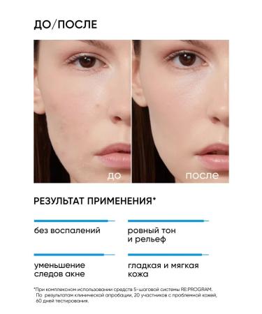 PeelinZone Facial peeling 11% of acne and inflammation - Buy Online on GoSupps.com