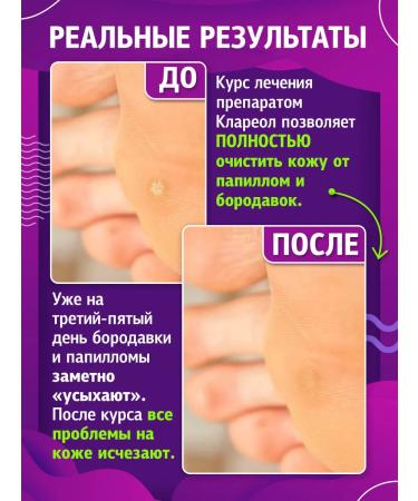 GLS Wellness Center 1+1 Innoskin Clareol Gel-Exfoliant from papillomas and warts - Buy Online on GoSupps.com