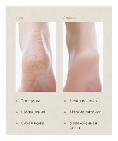 Cream wax from cracks and peeling for hands and body set 3pcs - Buy Online on GoSupps.com