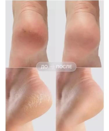 Cream wax from cracks and peeling for hands and body set 3pcs - Buy Online on GoSupps.com