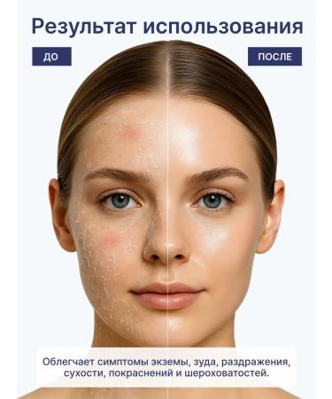 DERMEDIC Cicatopy face cream for atopic skin - Buy Online on GoSupps.com