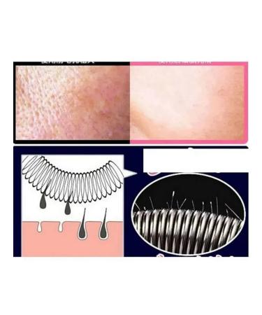 Facial epalator is a manual spring - Buy Online on GoSupps.com