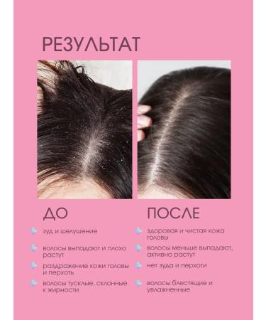 PeelinZone System 4 Piling for scalp 500 ml - Buy Online on GoSupps.com