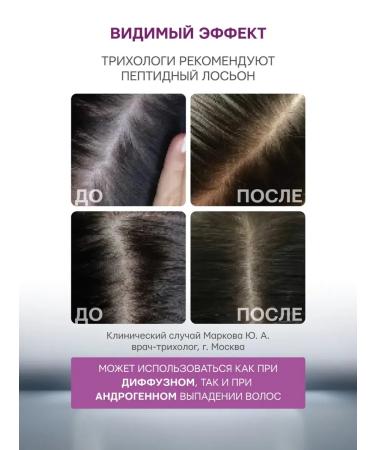 SeruZone Serum from falling out and for hair growth peptide - Buy Online on GoSupps.com