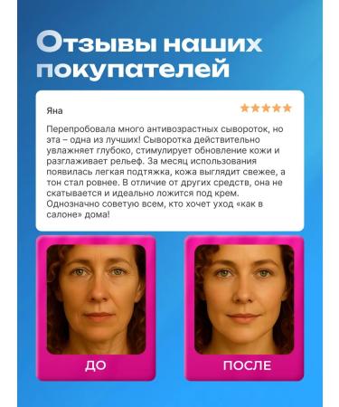 Ivcos Facial serum moisturizing from wrinkles anti -Eiga - Buy Online on GoSupps.com