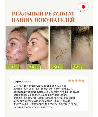 Tokishi LV Acne and post -acne cream - Buy Online on GoSupps.com