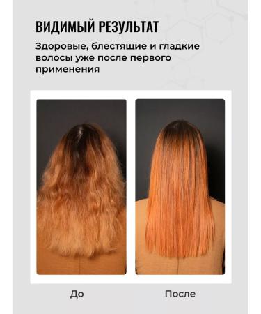 SeruZone Multivitamin hair complex restoring - Buy Online on GoSupps.com