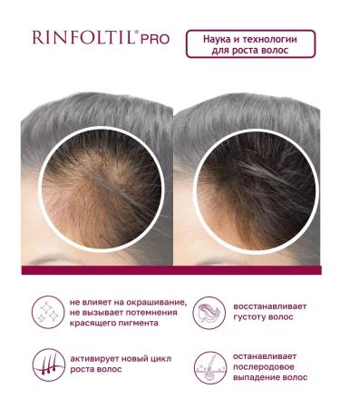 SeruZone Pro Cure Professional from hair loss for women - Buy Online on GoSupps.com