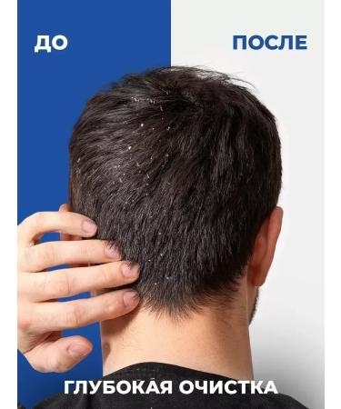 Head & Shoulders Shampoo main hair care 3 pcs - Buy Online on GoSupps.com