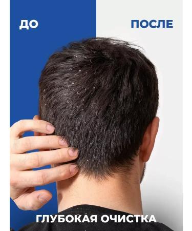Head & Shoulders Shampoo main hair care 5 pcs - Buy Online on GoSupps.com