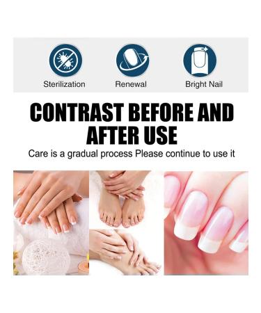 Pencil against nail fungus bio 1 pc - Buy Online on GoSupps.com