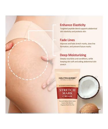 NEUTRIHERBS Cream against stretch marks - Buy Online on GoSupps.com
