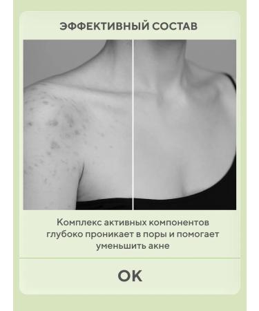 BEAUTIFIC Shower gel with acids from acne AWAY 300 ml - Buy Online on GoSupps.com