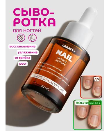 Creatyy Serum for the growth of nails against the fungus of stop onycholysis