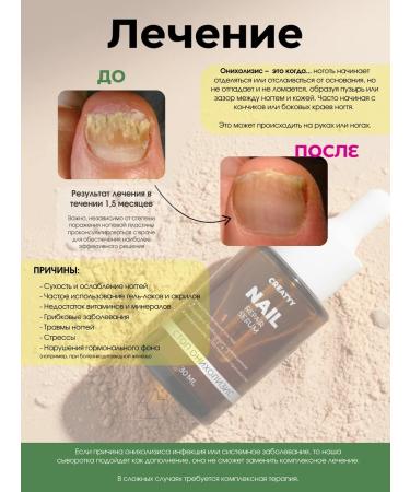 Creatyy Serum for the growth of nails against the fungus of stop onycholysis - Buy Online on GoSupps.com
