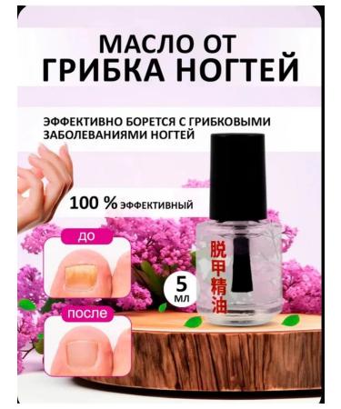 Portofino Nail fungus remedy