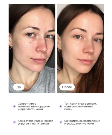 LU MINATE Face serum set 3 pcs - Buy Online on GoSupps.com