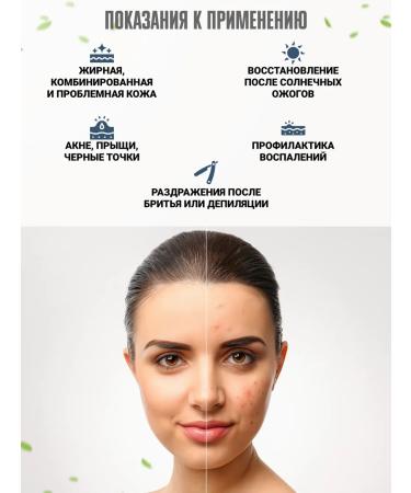 Erawadee Thai Sos-gel for problem skin - Buy Online on GoSupps.com