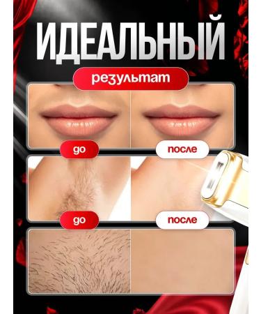 Unlimited photoepilator for hair removal - Buy Online on GoSupps.com