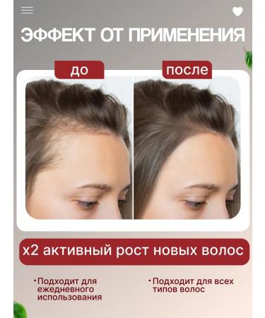 MEIDU Hair growth shampoo - Buy Online on GoSupps.com