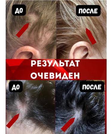 INTRIGU Shampoo from falling out and for hair growth - Buy Online on GoSupps.com