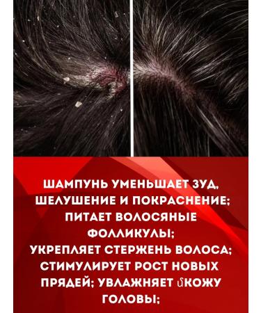 INTRIGU Shampoo from falling out and for hair growth - Buy Online on GoSupps.com