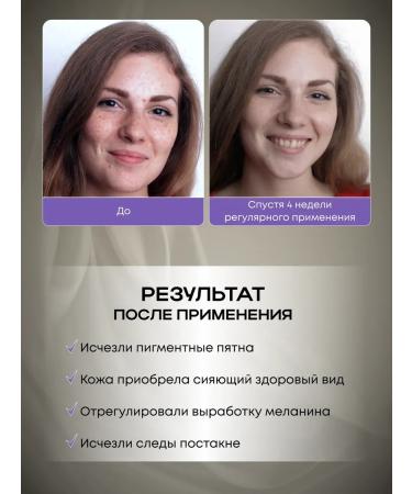 Cosmetics Facial and body whitening cream - Buy Online on GoSupps.com