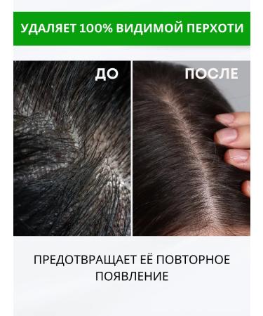 SeruZone Hair serum from dandruff of zinc with climonon - Buy Online on GoSupps.com