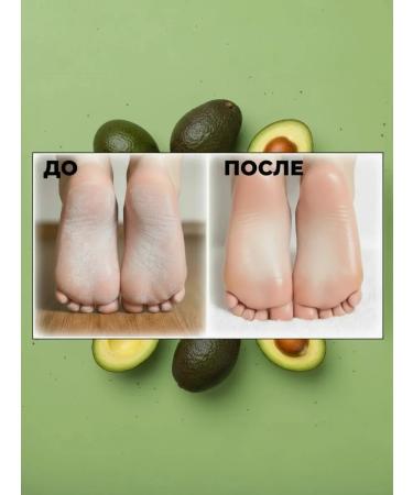 Mask pedicure toes for legs from cracks and corns - Buy Online on GoSupps.com