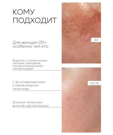 LAURA ZACKARYA Facial serum with vitamin C against pigmentation - Buy Online on GoSupps.com