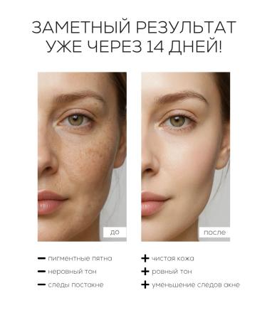 LAURA ZACKARYA Facial serum with vitamin C against pigmentation - Buy Online on GoSupps.com