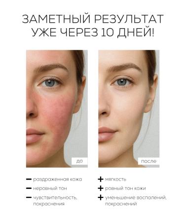 LAURA ZACKARYA Wede moisturizer for sensitive skin in ampoules - Buy Online on GoSupps.com