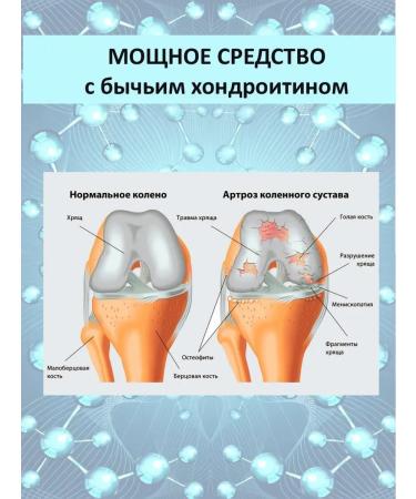HealincosmeticPro Chondroitin with glucosamine for joints 125 ml - Buy Online on GoSupps.com