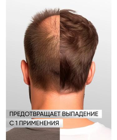 KEUNE Haircosmetics Strengthening Lotion Against Hair Loss 75 ml - Buy Online on GoSupps.com