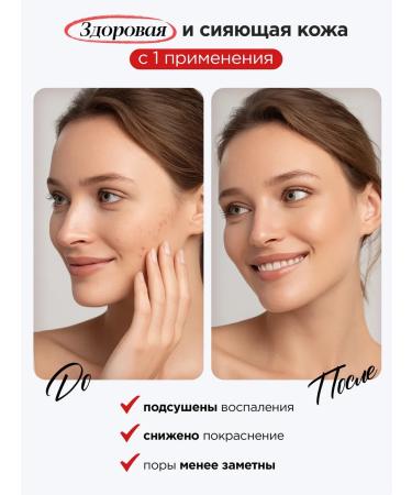 MIXIT Facial serum lightening from acne with niacinamide - Buy Online on GoSupps.com