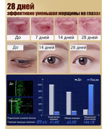 LYDIMOON Anti -aging cream eliminates dark circles and wrinkles - Buy Online on GoSupps.com