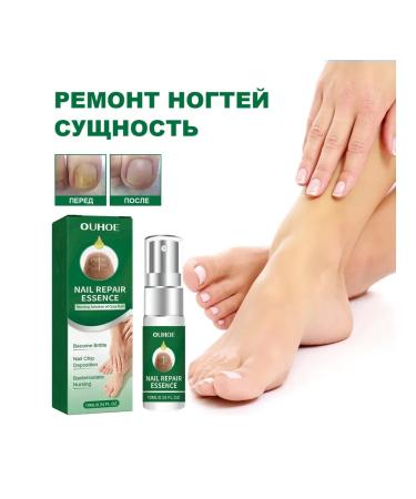 Nail repair entity eliminate fungi promotes growth - Buy Online on GoSupps.com