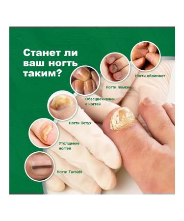 Nail repair entity eliminate fungi promotes growth - Buy Online on GoSupps.com