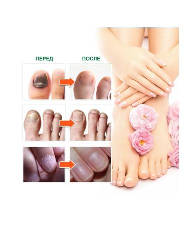 Nail repair entity eliminate fungi promotes growth - Buy Online on GoSupps.com