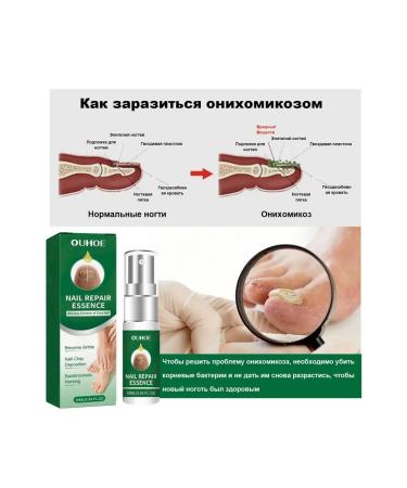 Nail repair entity eliminate fungi promotes growth - Buy Online on GoSupps.com