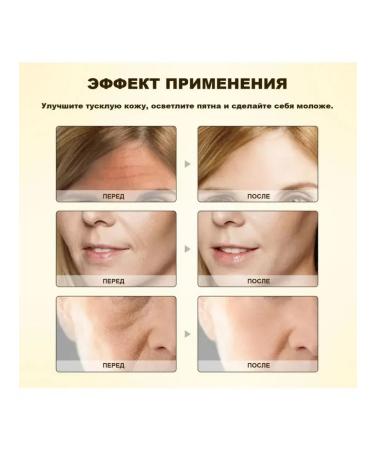 Ouhoe Smoothing wrinkles with bees venom cream tighten your face skin - Buy Online on GoSupps.com