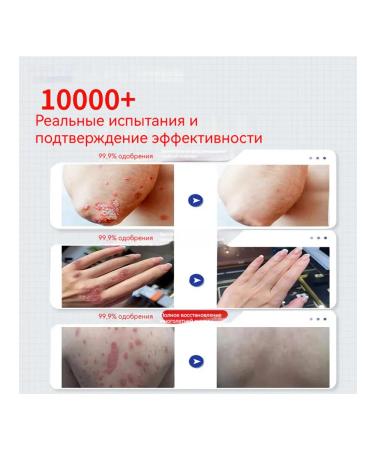 Psoriasis ointment effective for the body - Buy Online on GoSupps.com