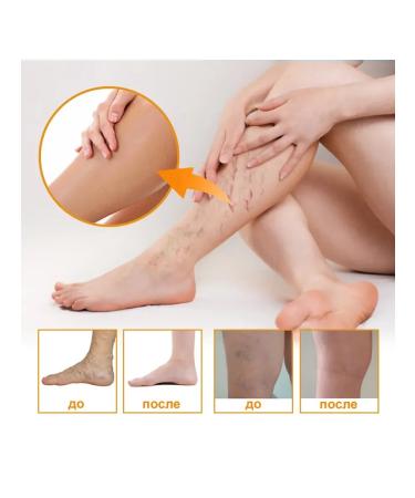 eelhoe Relieves swelling of the care of care cream eliminates bruises 60 g - Buy Online on GoSupps.com