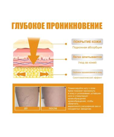 eelhoe Relieves swelling of the care of care cream eliminates bruises 60 g - Buy Online on GoSupps.com