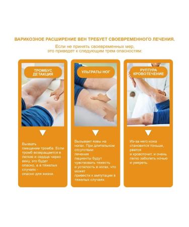 eelhoe Relieves swelling of the care of care cream eliminates bruises 60 g - Buy Online on GoSupps.com