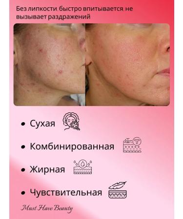 K-Secret Facial Cream SEUL 1988 Cream Snail Mucin 93% + Rice - Buy Online on GoSupps.com