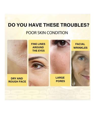 Eelhoe lifting and protein thread lifting set - Buy Online on GoSupps.com