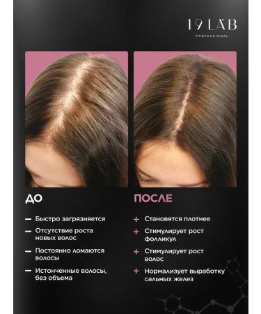 SeruZone Peptide hair growth - Buy Online on GoSupps.com