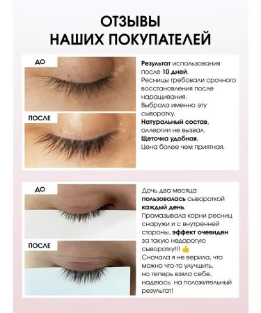 SeruZone Serum for eyelashes - Buy Online on GoSupps.com