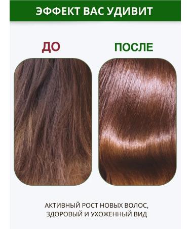 SeruZone Hair serum nettle with nicotinic acid - Buy Online on GoSupps.com